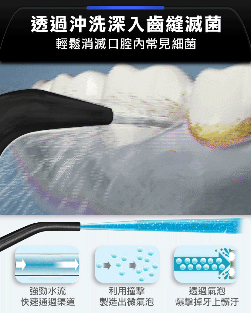 Future Lab OCare Clean 藍氧洗牙機 (**落單前先查詢貨量🙏🏼)