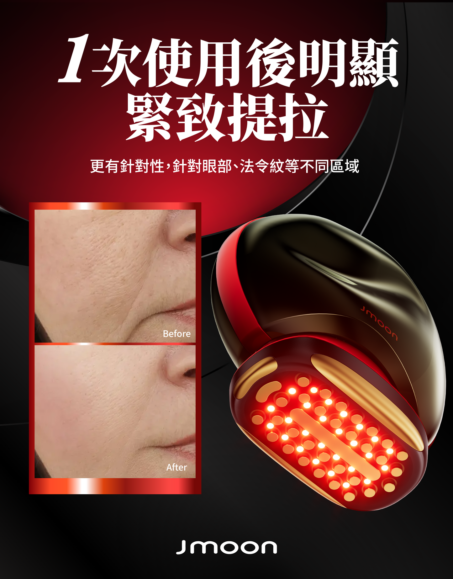 J moon M30 Max 膠原炮家用射頻美容儀