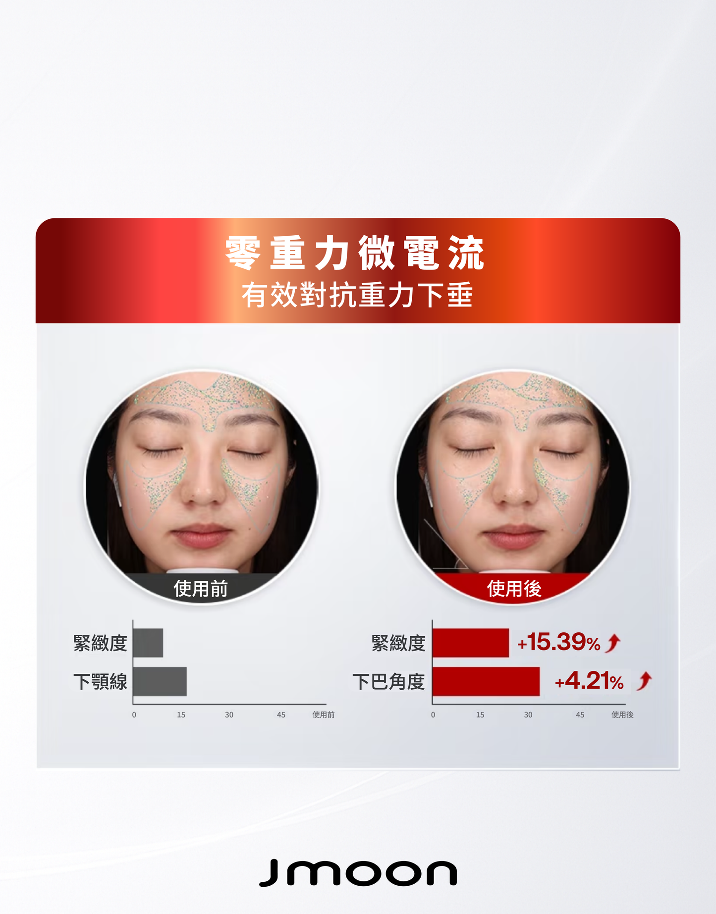 J moon M30 Max 膠原炮家用射頻美容儀