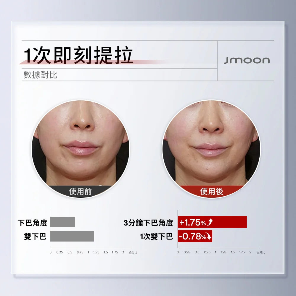 J moon EM50透皮膠原光牛奶光美容儀