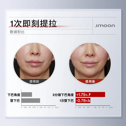 J moon EM50透皮膠原光牛奶光美容儀